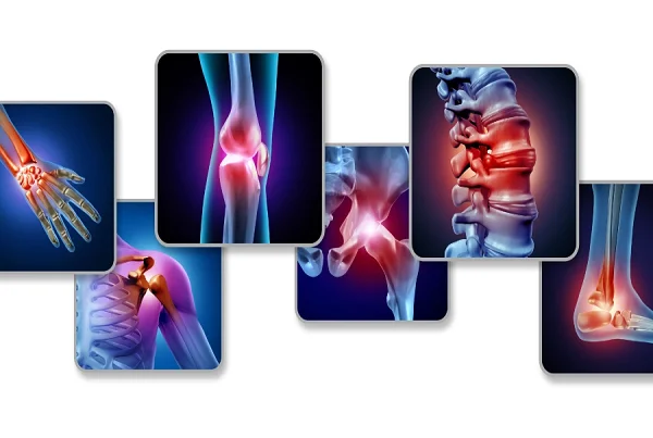 Joint Pains