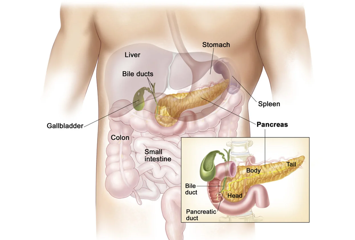 Pancreatitis