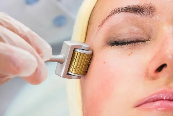 Dermaplanning