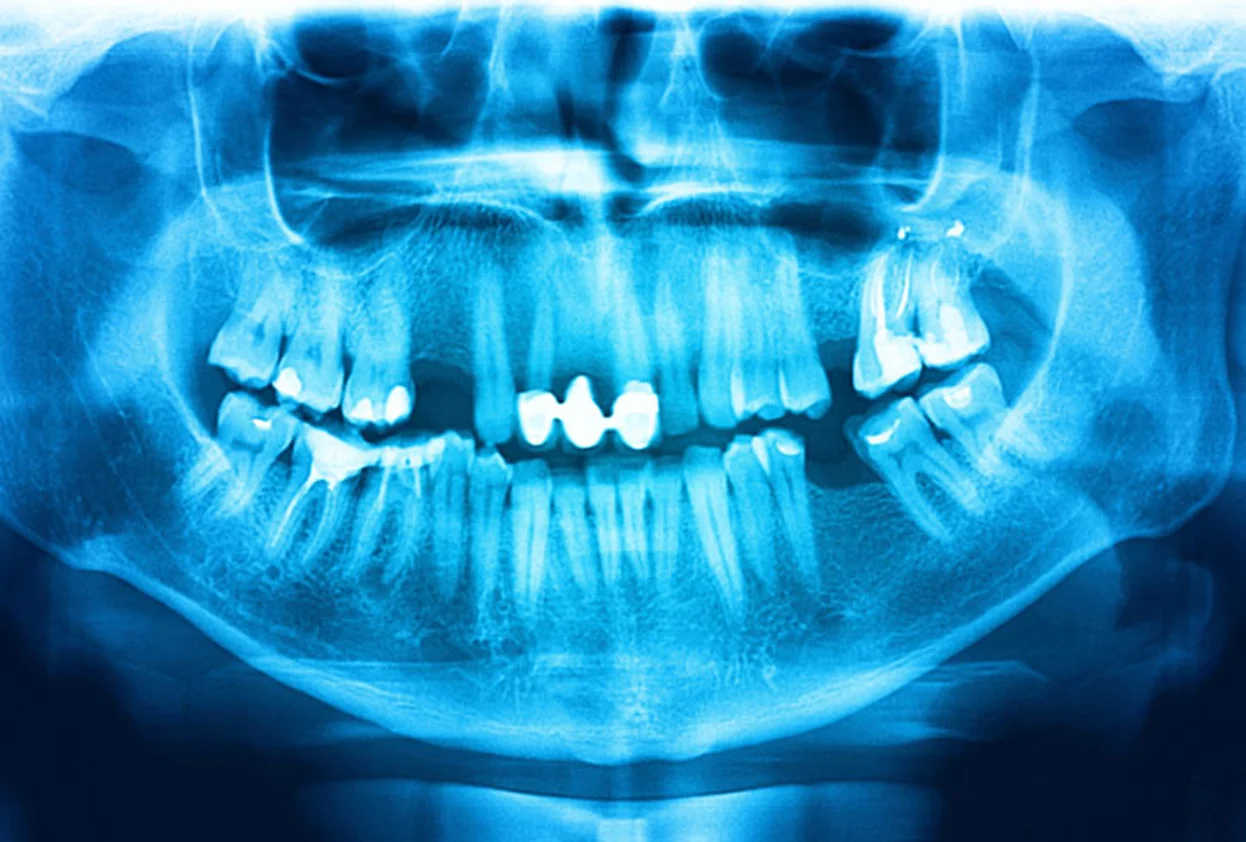 Full Exams and Dental X-Ray