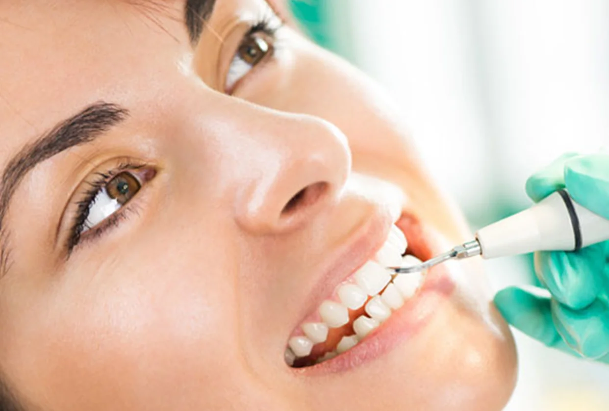 Dental Cleaning