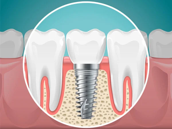Dental